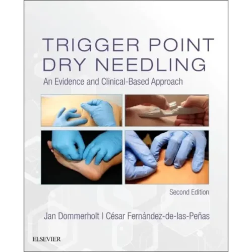 Trigger Point Dry Needling: An Evidence and Clinical-Based Approach